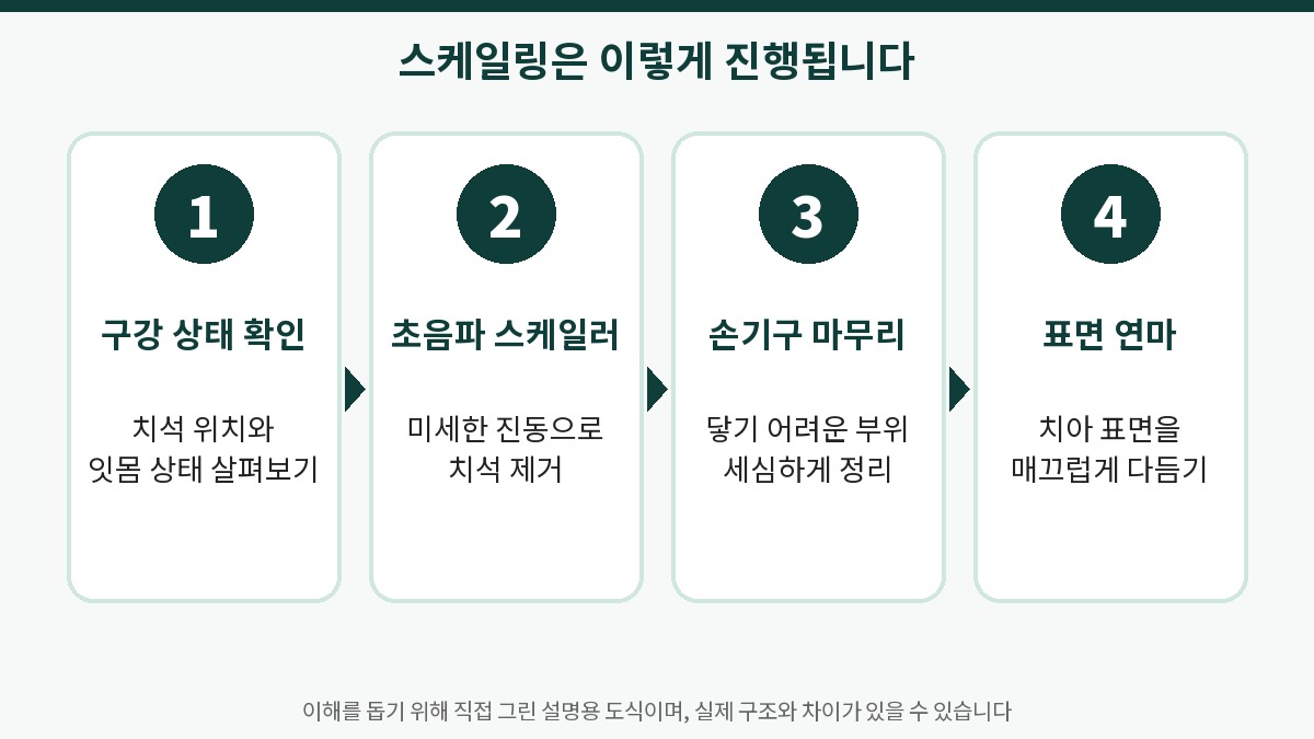 스케일링 진행 순서 4단계: 구강 확인, 초음파 스케일러, 손기구 마무리, 표면 연마